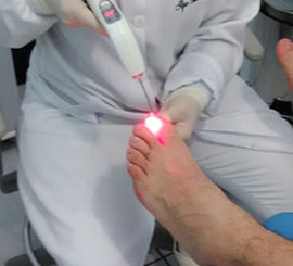 laserterapia